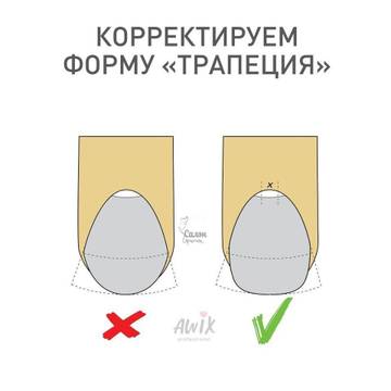 http://forumupload.ru/uploads/0014/3b/b9/2/t728941.jpg