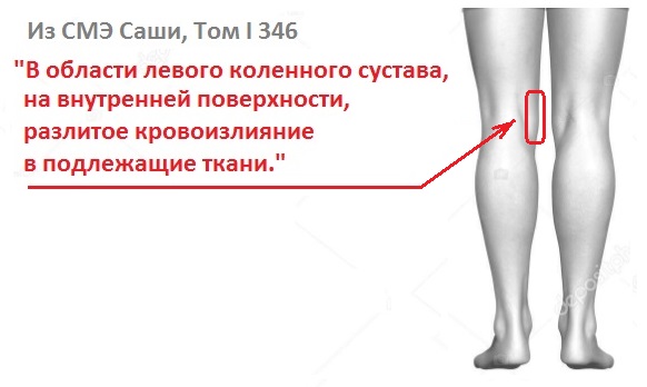 http://forumupload.ru/uploads/001a/7e/41/2/984434.jpg