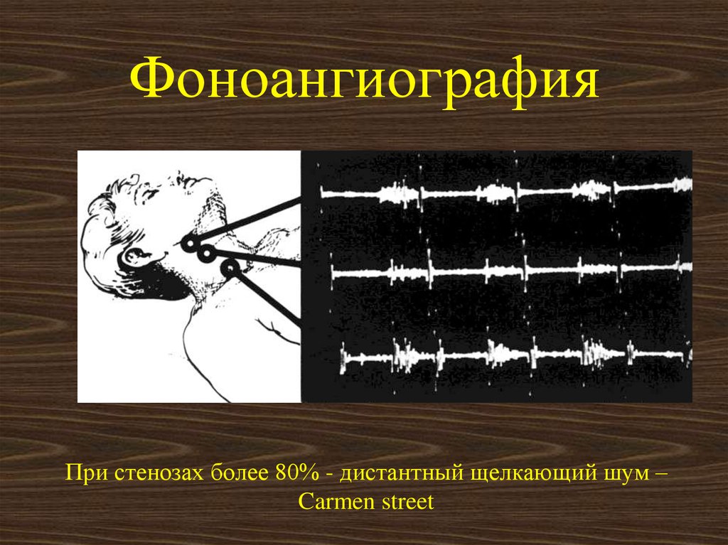 https://forumupload.ru/uploads/0001/48/78/2003/859645.jpg