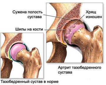 https://forumupload.ru/uploads/0001/77/fd/341/t430273.jpg