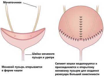 https://forumupload.ru/uploads/001b/a3/de/2/t559090.jpg