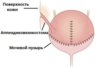 https://forumupload.ru/uploads/001b/a3/de/2/t831947.jpg