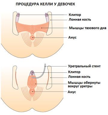 https://forumupload.ru/uploads/001b/a3/de/2/t855538.png